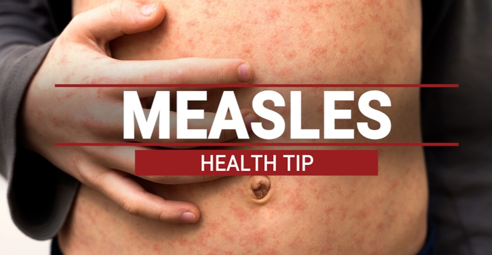New Halton measles case may have spread from earlier one